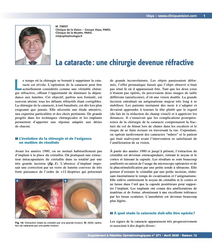 chirurgie-cataracte-article