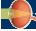 oeil-hypermetrope-vision